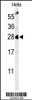 Western blot analysis of RAB8A Antibody in Hela cell line lysates (35ug/lane)