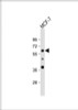 Western Blot at 1:1000 dilution + MCF-7 whole cell lysate Lysates/proteins at 20 ug per lane.