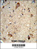 Formalin-fixed and paraffin-embedded human brain tissue reacted with DAB1 Antibody, which was peroxidase-conjugated to the secondary antibody, followed by DAB staining.