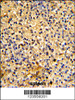 Formalin-fixed and paraffin-embedded human spleen tissue reacted with LY75 Antibody, which was peroxidase-conjugated to the secondary antibody, followed by DAB staining.