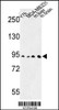 Western blot analysis of DPP10 Antibody in Y79, MDA-MB231 cell line and mouse liver, brain tissue lysates (35ug/lane)