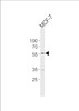 Western blot analysis of lysate from MCF-7 cell line, using NAMPT Antibody at 1:1000.