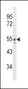 Western blot analysis of NAMPT Antibody in A375 cell line lysates (35ug/lane)