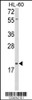 Western blot analysis of DLK2 Antibody in HL-60 cell line lysates (35ug/lane)