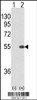 Western blot analysis of STK40 using rabbit polyclonal STK40 using 293 cell lysates (2 ug/lane) either nontransfected (Lane 1) or transiently transfected with the STK40 gene (Lane 2) .