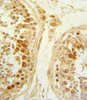 Formalin-fixed and paraffin-embedded human testis tissue reacted with SFRP1 Antibody (N-term) , which was peroxidase-conjugated to the secondary antibody, followed by DAB staining.