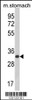 Western blot analysis of CDIPT Antibody in mouse stomach tissue lysates (35ug/lane)