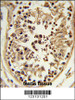 Formalin-fixed and paraffin-embedded human testis tissue reacted with CHPF Antibody, which was peroxidase-conjugated to the secondary antibody, followed by DAB staining.