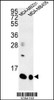 Western blot analysis of SPRR1B Antibody in MDA-MB231, MDA-MB435 cell line lysates (35ug/lane)