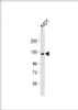 Western Blot at 1:1000 dilution + A431 whole cell lysate Lysates/proteins at 20 ug per lane.