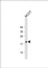 Western Blot at 1:1000 dilution + NCCIT whole cell lysate Lysates/proteins at 20 ug per lane.