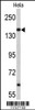 Western blot analysis of NUP153 Antibody in Hela cell line lysates (35ug/lane)