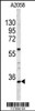 Western blot analysis of HOXA9 Antibody in A2058 cell line lysates (35ug/lane)
