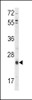 Western blot analysis of TIMP3 Antibody in HepG2 cell line lysates (35ug/lane)