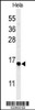 Western blot analysis of GABARAPL1 Antibody in Hela cell line lysates (35ug/lane)