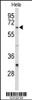 Western blot analysis of CDC20 Antibody in Hela cell line lysates (35ug/lane)