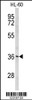 Western blot analysis of PEX14 Antibody in HL-60 cell line lysates (35ug/lane)