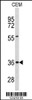 Western blot analysis of PEX16 Antibody in CEM cell line lysates (35ug/lane)