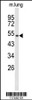 Western blot analysis of MUTYH Antibody in mouse lung tissue lysates (35ug/lane)