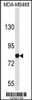 Western blot analysis of EVI5 Antibody in MDA-MB468 cell line lysates (35ug/lane)