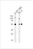 Western blot analysis of lysates from U-251 MG, PC-3 cell line (from left to right) , using DEK Antibody at 1:1000 at each lane.