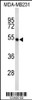 Western blot analysis of FLAD1 Antibody in MDA-MB231 cell line lysates (35ug/lane)