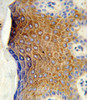 Formalin-fixed and paraffin-embedded human skin tissue reacted with GALNT3 Antibody, which was peroxidase-conjugated to the secondary antibody, followed by DAB staining.