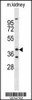 Western blot analysis of FOXL1 Antibody in mouse kidney tissue lysates (35ug/lane)