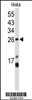 Western blot analysis of CENPH Antibody in Hela cell line lysates (35ug/lane)