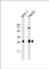 Western Blot at 1:1000 dilution Lane 1: MCF-7 whole cell lysate Lane 2: HepG2 whole cell lysate Lysates/proteins at 20 ug per lane.