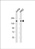 Western Blot at 1:1000 dilution Lane 1: Jurkat whole cell lysate Lane 2: K562 whole cell lysate Lysates/proteins at 20 ug per lane.