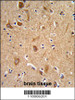 Formalin-fixed and paraffin-embedded human brain tissue reacted with CD49f Antibody, which was peroxidase-conjugated to the secondary antibody, followed by DAB staining.