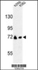 Western blot analysis of GFPT2 Antibody in A2058, K562 cell line lysates (35ug/lane)