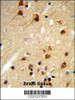 Formalin-fixed and paraffin-embedded human brain tissue reacted with CENPK Antibody, which was peroxidase-conjugated to the secondary antibody, followed by DAB staining.
