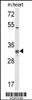 Western blot analysis of COQ5 Antibody in mouse heart tissue lysates (35ug/lane)