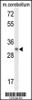 Western blot analysis of DAGLB Antibody in mouse cerebellum tissue lysates (35ug/lane)