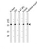 Western Blot at 1:1000 dilution Lane 1: human heart lysate Lane 2: 293 whole cell lysate Lane 3: U-87 MG whole cell lysate Lane 4: human brain lysate Lane 5: human skeletal muscle lysate Lysates/proteins at 20 ug per lane.