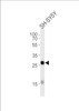 Western blot analysis in SH-SY5Y cell line lysates (35ug/lane) .