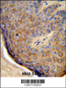 Formalin-fixed and paraffin-embedded human skin tissue reacted with TCHP Antibody, which was peroxidase-conjugated to the secondary antibody, followed by DAB staining.