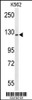 Western blot analysis of TREF1 Antibody in K562 cell line lysates (35ug/lane)