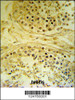 IMP4 Antibody IHC analysis in formalin fixed and paraffin embedded human testis carcinoma followed by peroxidase conjugation of the secondary antibody and DAB staining.
