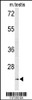 Western blot analysis of UNC119 Antibody in mouse testis tissue lysates (35ug/lane)