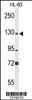 Western blot analysis of MCM2 Antibody in HL-60 cell line lysates (35ug/lane)