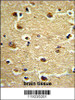 Formalin-fixed and paraffin-embedded human brain tissue reacted with CROT Antibody (N-term) , which was peroxidase-conjugated to the secondary antibody, followed by DAB staining.