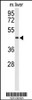 Western blot analysis of CHIA Antibody in mouse liver tissue lysates (35ug/lane)