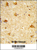 Formalin-fixed and paraffin-embedded human brain tissue reacted with DIRAS1 Antibody, which was peroxidase-conjugated to the secondary antibody, followed by DAB staining.