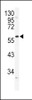 Western blot analysis of ADRA1B Antibody in NCI-H460 cell line lysates (35ug/lane)