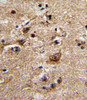 Formalin-fixed and paraffin-embedded human brain with ADRA1B Antibody, which was peroxidase-conjugated to the secondary antibody, followed by DAB staining.