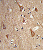 Formalin-fixed and paraffin-embedded human brain tissue reacted with CPLX1 Antibody, which was peroxidase-conjugated to the secondary antibody, followed by DAB staining.