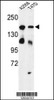 Western blot analysis of HDLBP Antibody in A2058, T47D cell line lysates (35ug/lane)
